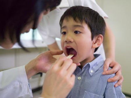 Trẻ viêm thanh quản thường sốt và đau họng