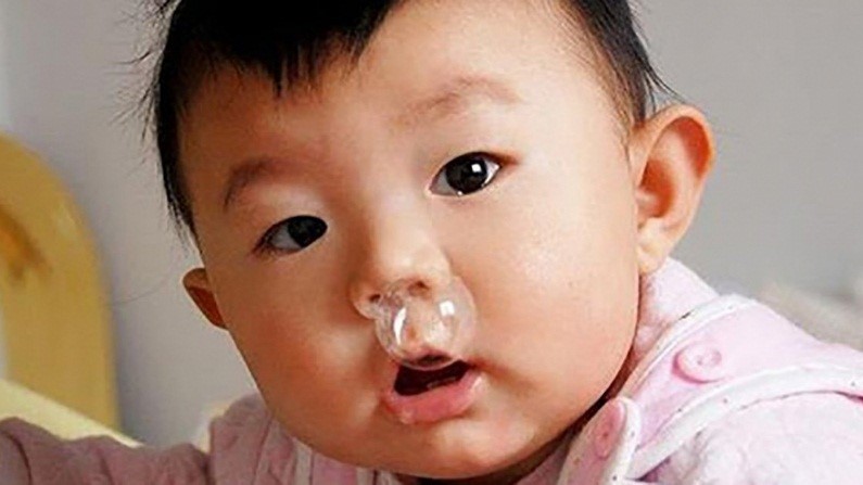 Nguyên nhân trẻ sơ sinh hắt hơi sổ mũi?